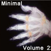 Minimal Volume 22